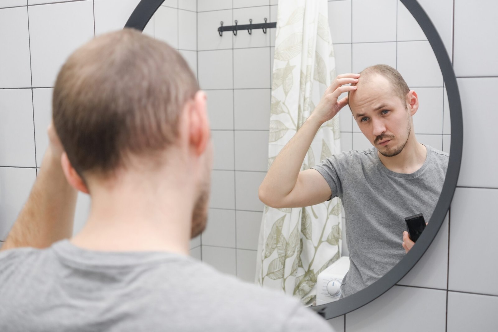 a man with hair loss problem wondering if there is any cure